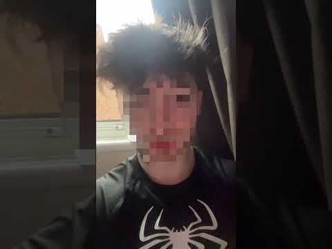 Snapchat No Media Upload Solution 2025!