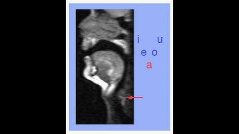Vocal tract producing vowels