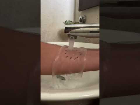 Que hacer si