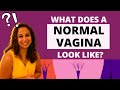 What does a NORMAL vagina look like? | Answers Dr. Niveditha Manokaran