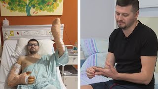 Хирурги из Москвы пришили мужчине кисть руки