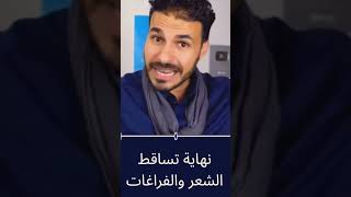 نهاية تساقط الشعر والفراغات / خلاصة الطريق الى شعر غزير لامع مجموعة طبيعية