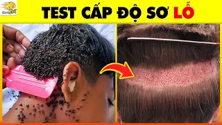 Test Hội Chứng Sợ Lỗ - Đoán 13 Bức Ảnh Giúp Bạn Không Bao Giờ Mắc Phải | Nhanh Trí