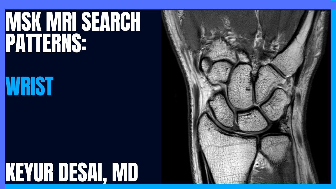 MSK MRI Search Patterns from Dr. Keyur Desai: Wrist