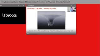 How to Leverage Laser Capture Microdissection Technology for Advanced Oncology Research