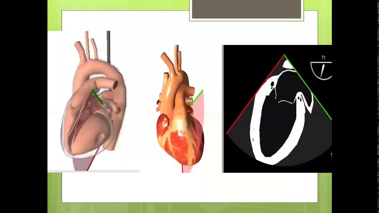 CMR tracings - Dr  Ahmed Asfour