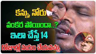 Viddhakarma in telugu | Treatment For Facial Paralysis In Telugu | Dr. Suchitha | Health Tree