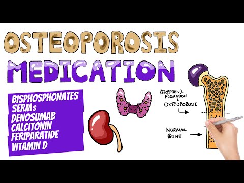 Video: Osteoporosis Treatment - 5 Modern Methods Of Osteoporosis Treatment