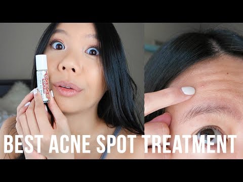 Best Acne Spot Treatment! The Better Skin Company Zit No More