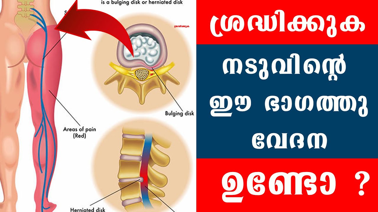 ഈ ദിവസങ്ങളിൽ നടുവിന്റെ ഈ ഭാഗത്തു വേദന അനുഭവപ്പെടുന്നുണ്ടോ ശ്രദ്ധിക്കുക /Baiju's Vlogs