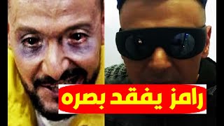 عاجل/ رامز جلال يفقد بصره ويصاب بالعمى ما الحقيقة ؟ ورد فعل النقابة وأخوه ياسر جلال هل انقلب السحر؟؟