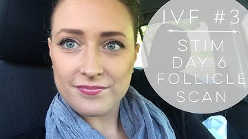 IVF #3 | STIM DAY 6 FOLLICLE SCAN