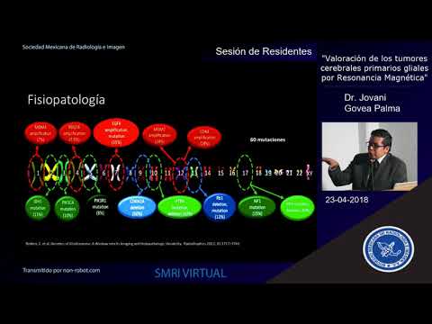 Vídeo: Gliosis Del Cerebro: Focos, Tratamiento, Tipos, Signos