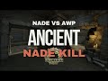 Grenade kill cs2 gameplay  cs2shorts csgo cs2 gamingshorts