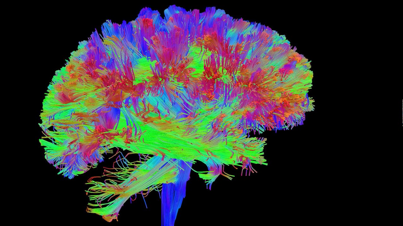 neurology department Cavin's Brain in HDFT