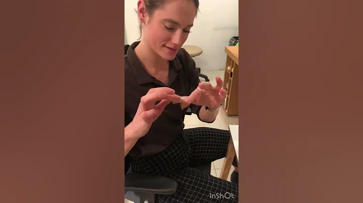 Ulnar sided wrist pain taping technique