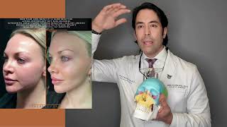 CIS FACIAL FEMINIZATION