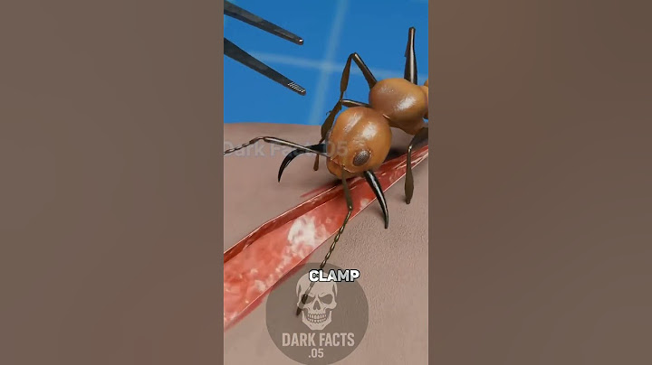 Using Ants To Stitch Wounds