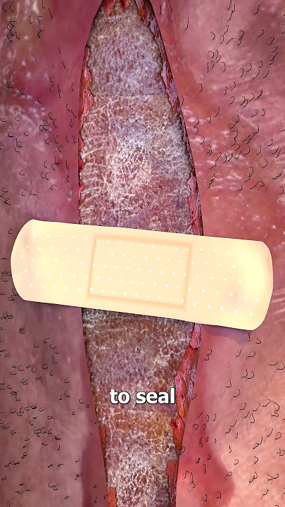 Small Band-Aid vs Huge Wound 😨