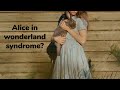 Things appeared smaller and bigger? | Alice in wonderland syndrome/ Todd&#39;s syndrome