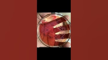 #Bacterial colonies#| culture media |bacterial growth of agar plate|
