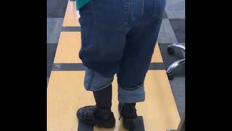 OPC PATIENT - Walking with a new Below Knee Prosthesis