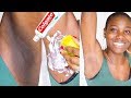 HOW TO LIGHTEN DARK UNDERARMS NATURALLY & FAST WITH COLGATE TOOTHPASTE & LEMON