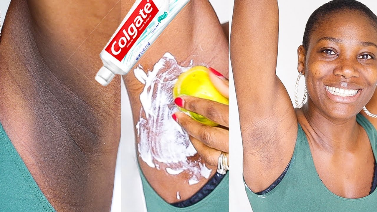 How To Lighten Dark Underarms Naturally  Fast With Colgate Toothpaste  Lemon