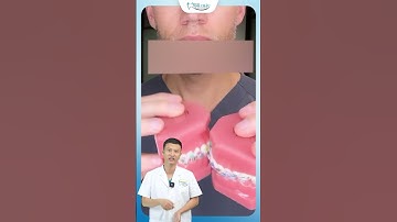 Đá Lưỡi Có Tác Dụng Gì Hay là hậu Quả Nghiêm Trọng| Bác Sĩ Yên