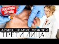Армирование нижней трети лица жидкими нитями