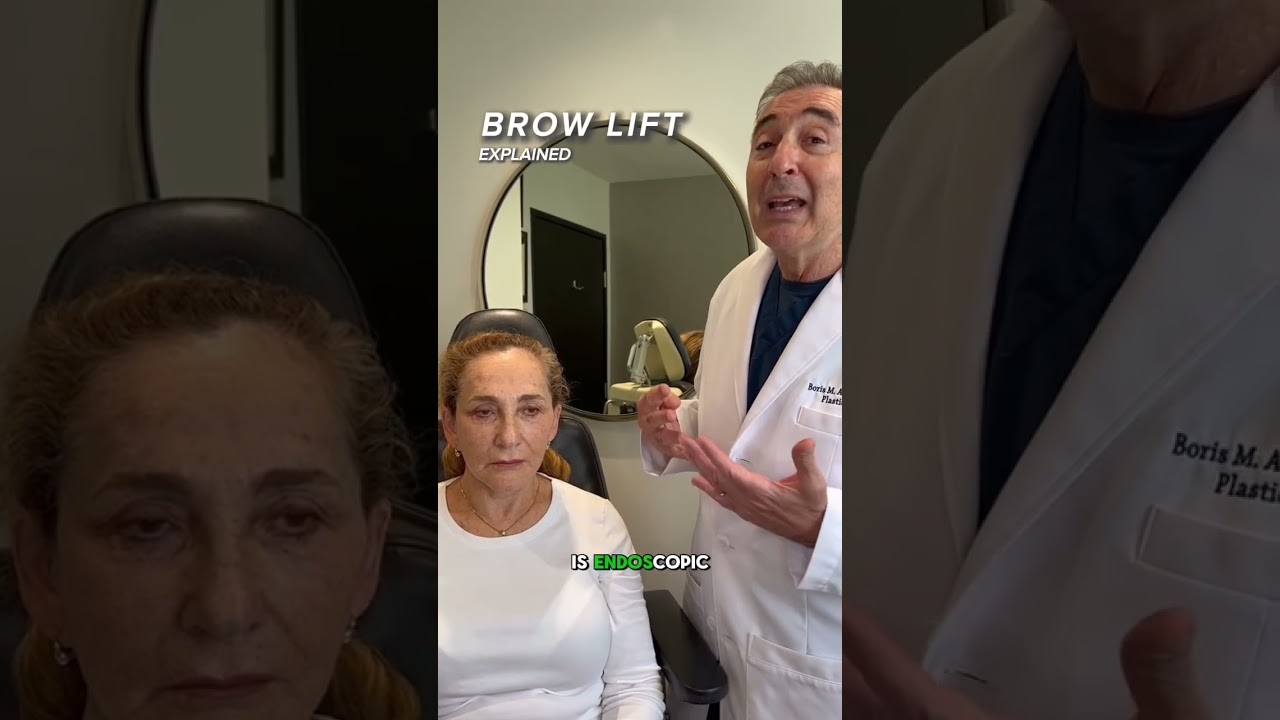 Brow Lift Explained