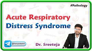 7. Acute Respiratory Distress Syndrome | USMLE Step 1 Pathology