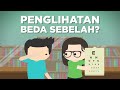 Kenapa Mata Kiri-Kanan Bisa Beda Minusnya?