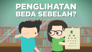 Kenapa Mata Kiri-Kanan Bisa Beda Minusnya?