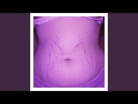 Putar Diet Culture (Stripped) - Brye