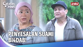 Download Lagu Gak Habis Fikir! Kok Mau Istri Rujuk Sama Suami Bi4dab?! | Catatan Hati Perempuan Eps 77 (4/4) MP3 Download Lagu Gak Habis Fikir! Kok Mau Istri Rujuk Sama Suami Bi4dab?! | Catatan Hati Perempuan Eps 77 (4/4) MP3