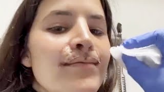 Pro Skater Brooklinn Khoury Shares Lip Reconstruction Progress 3 Years After Dog Attack