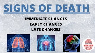 Signs of death | Immediate, early and late changes after death | Forensic science notes