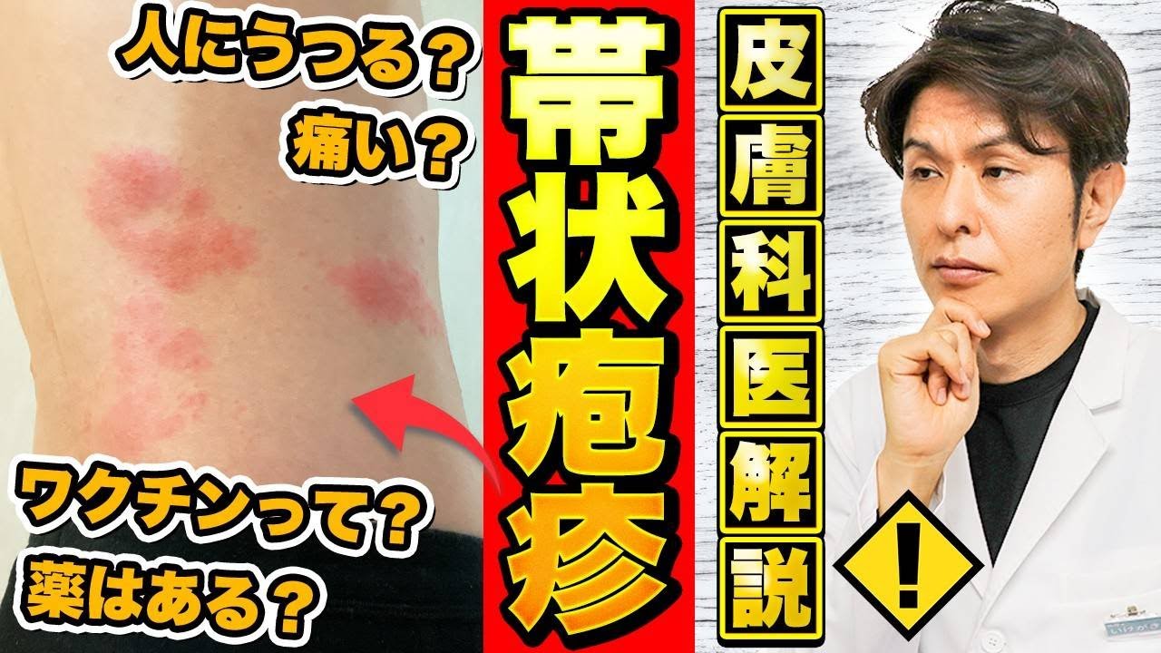 帯状疱疹水疱瘡にかかってない: 帯状疱疹 水疱瘡にかかったことがない – TKRA