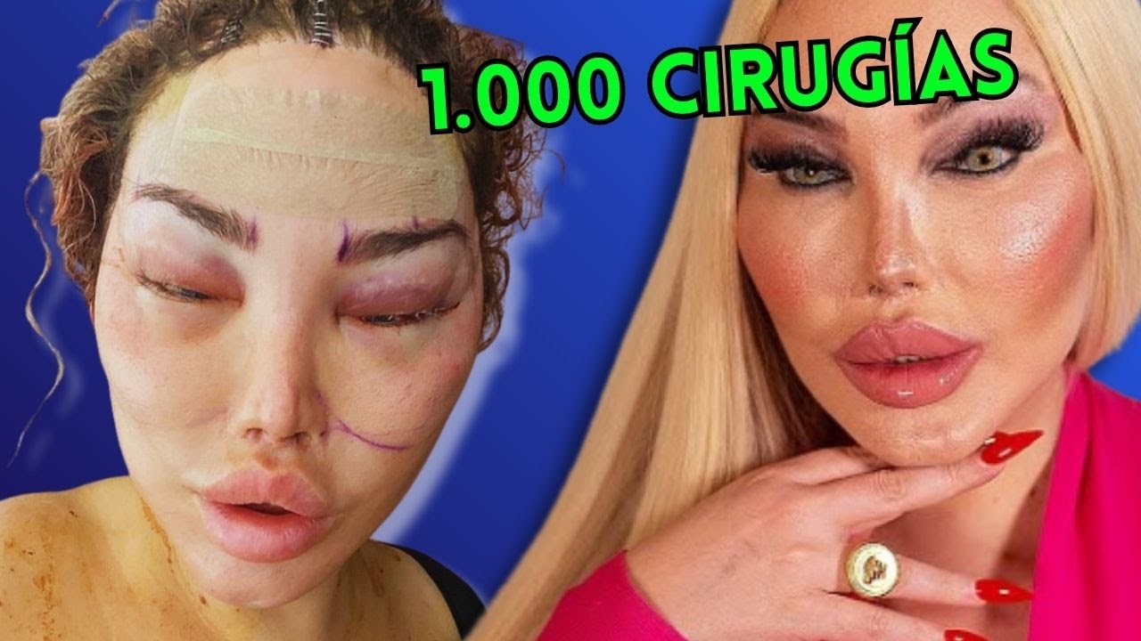 Se GASTÓ 1 Millón para DESTRUIR su Cara (El Horror de los Muñecos Humanos)