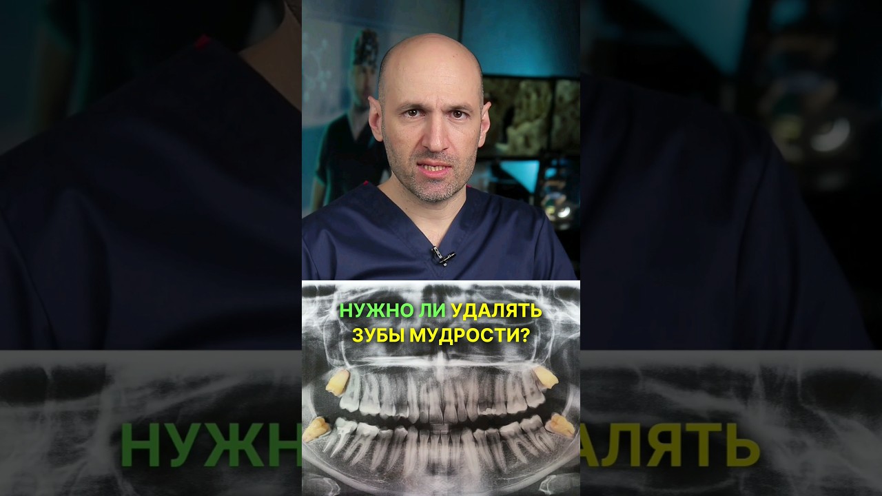 Чем опасны зубы мудрости #зубы #мудрости #члх