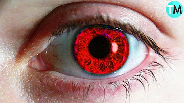¿Cuál es el 2º color de ojos más raro?