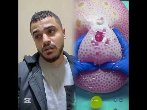 فيديو اخر الليل اشتراك حلو زيك جيفارا العلي موصللي محمد و رامي موصللي شعب الصيني ماله حل