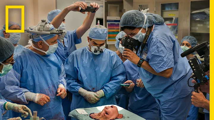 Youngest Face Transplant Recipient in U.S. | National Geographic - DayDayNews