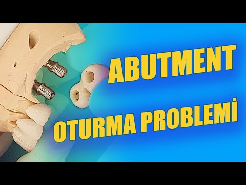 İmplant Üstü Abutment Oturma Problemi