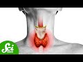 Thyroid Disease and Hormone Regulation