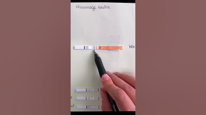 Miscarriage Timeline Breakdown
