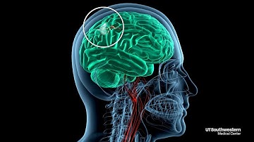 New study drives faster stroke response times