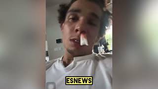 Devon Lee Says Was Jumped By Team Haney Esnews Boxing