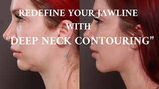 Improve Your Neck and Jawline Before Needing A Facelift